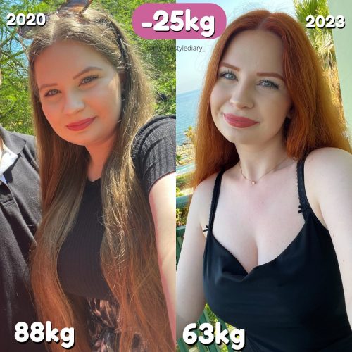 My_Lifestyle_diary_Nicole_Michalowski_Gesichtsveraenderung_Abnehmen_1